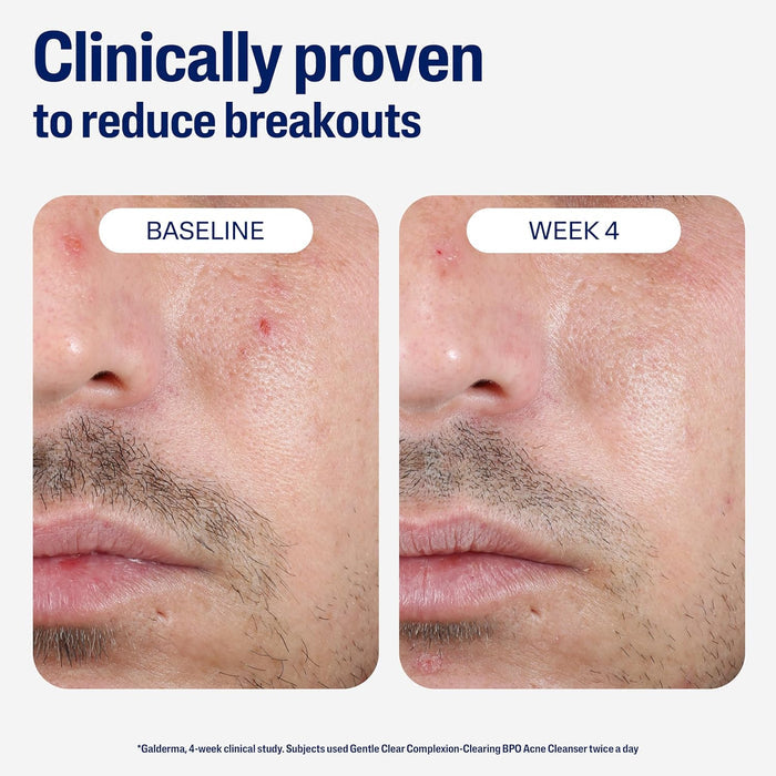 unscented, dermatologist-tested, suitable for acne-prone, dry, oily, normal, mature and sensitive skin