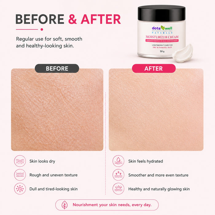 Face Moisturizer Cream for Deep Hydration & Skin Nourishment | Lightweight Care for Dry & Normal Skin | 50g