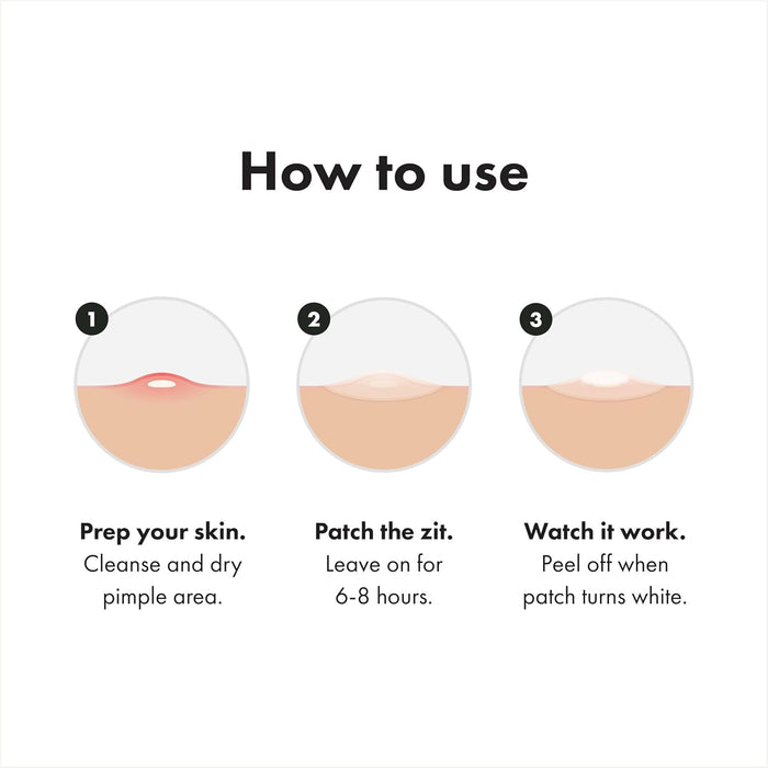 three patch types per box: 12 original, 12 invisible+, and 2 surface for varied pimple needs