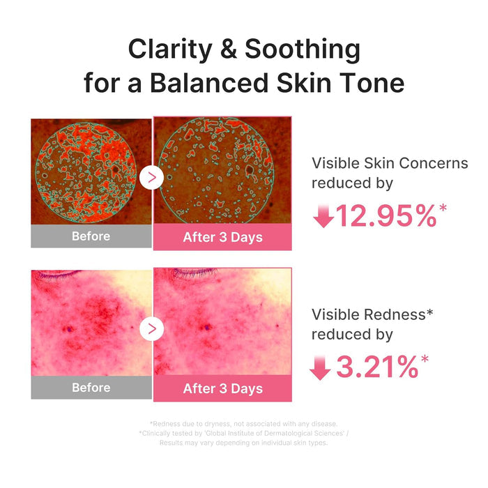 niacinamide and vitamin b12 for radiance and even-looking tone