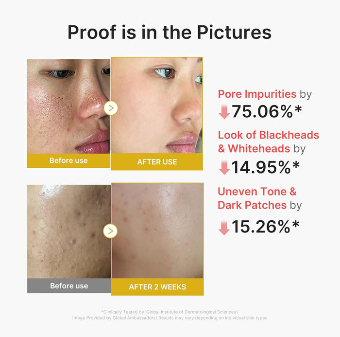 chemical exfoliant format — no physical scrubbing particles, reducing micro-damage risk