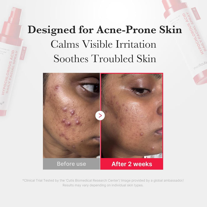 fine-mist spray nozzle designed for use over makeup without disturbing it