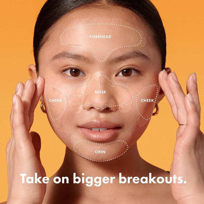 anatomically contoured shapes for forehead, nose, chin, and both cheeks