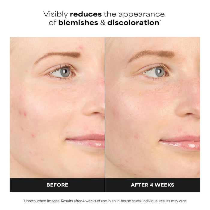 oil-free, fragrance-free cream-gel serum base suitable for sensitive skin